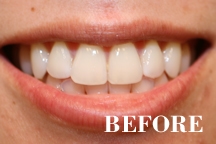 White Teeth and Bright Smiles â